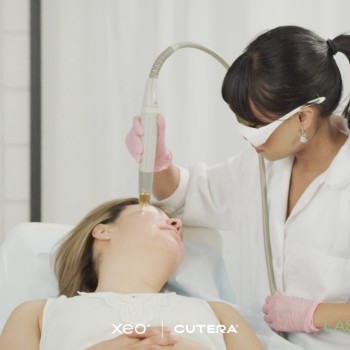 Laser Resurfacing Ottawa