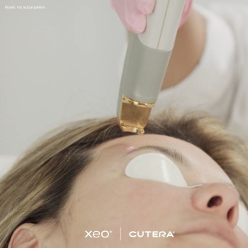 Skin Treatment Near Me Ottawa