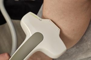 best-laser-hair-removal-ottawa