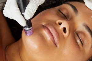 hydrafacial
